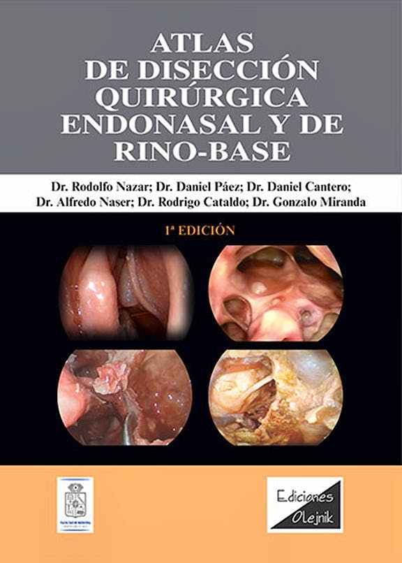 ATLAS DE DISECCIÓN QUIRÚRGICA ENDONASAL Y DE RINO-BASE